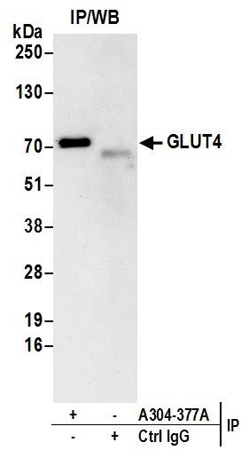 GLUT4 Antibody in Immunoprecipitation (IP)
