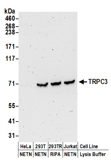 TRPC3 Antibody in Western Blot (WB)