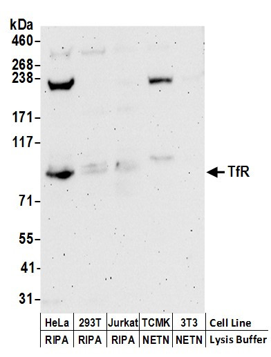 TfR Antibody in Western Blot (WB)