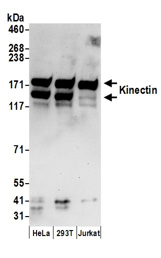 Kinectin Antibody in Western Blot (WB)