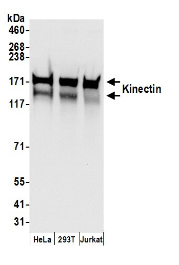 Kinectin Antibody in Western Blot (WB)