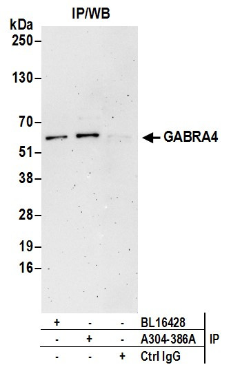 GABRA4 Antibody in Immunoprecipitation (IP)