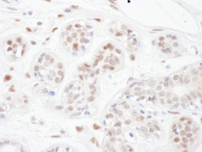 PINX1 Antibody in Immunohistochemistry (Paraffin) (IHC (P))