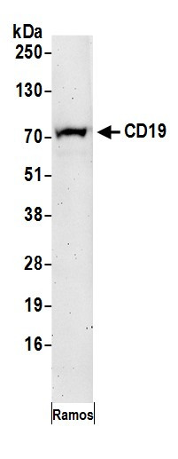 CD19 Antibody in Western Blot (WB)