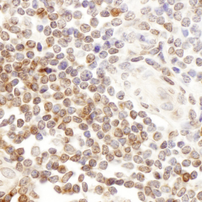 CD7 Antibody in Immunohistochemistry (Paraffin) (IHC (P))