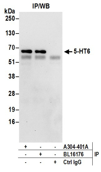 5-HT6 Antibody in Immunoprecipitation (IP)