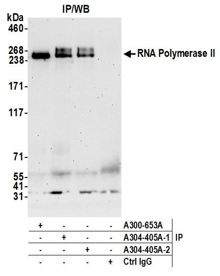 RNA Polymerase II Antibody in Immunoprecipitation (IP)