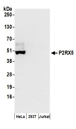 P2RX5 Antibody in Western Blot (WB)