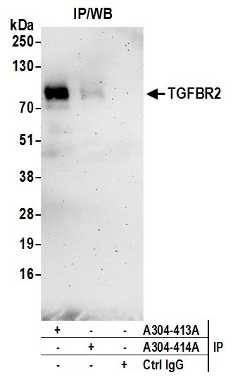 TGFBR2 Antibody in Immunoprecipitation (IP)