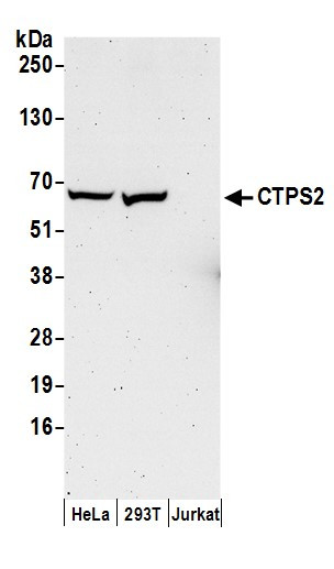 CTPS2 Antibody in Western Blot (WB)
