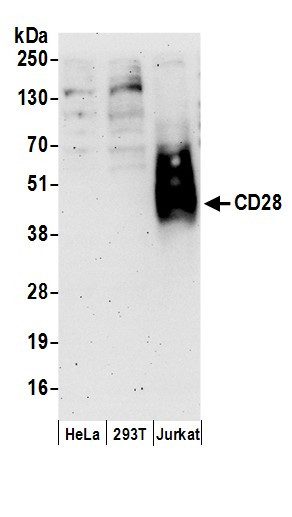 CD28 Antibody in Western Blot (WB)