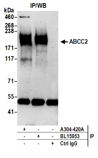 ABCC2 Antibody in Immunoprecipitation (IP)