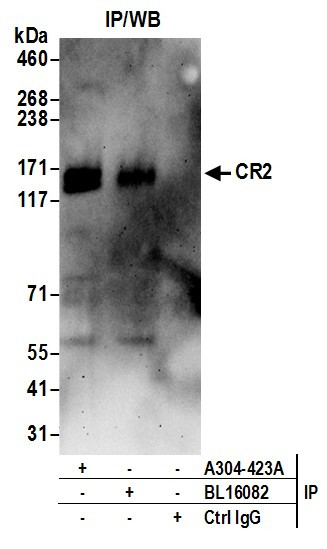 CR2 Antibody in Immunoprecipitation (IP)