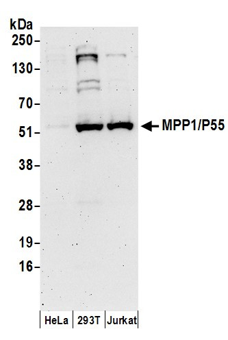 MPP1/P55 Antibody in Western Blot (WB)
