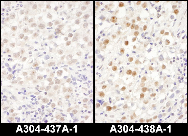 LAS1L Antibody in Immunohistochemistry (Paraffin) (IHC (P))