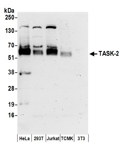 TASK-2 Antibody in Western Blot (WB)