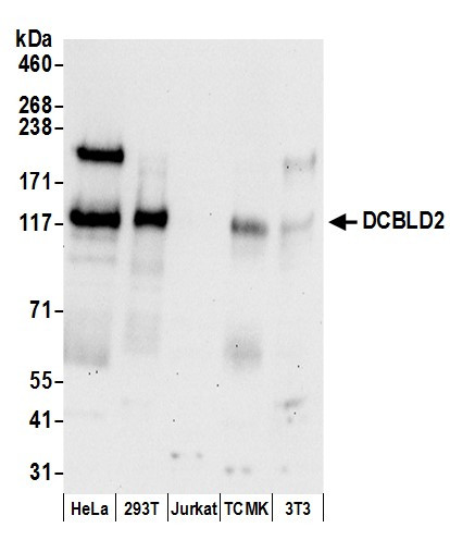 DCBLD2 Antibody in Western Blot (WB)