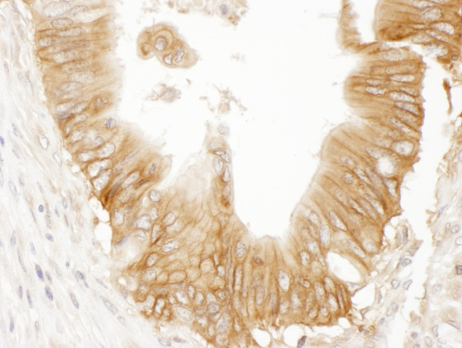 AC9 Antibody in Immunohistochemistry (Paraffin) (IHC (P))