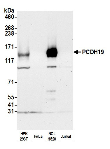 PCDH19 Antibody in Western Blot (WB)