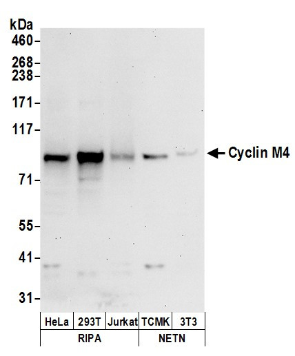 Cyclin M4 Antibody in Western Blot (WB)