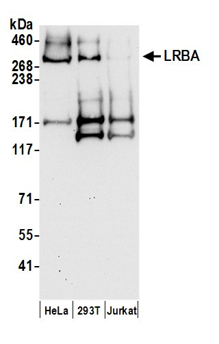 LRBA Antibody in Western Blot (WB)