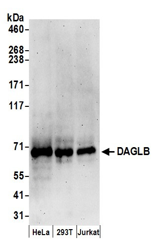 DAGLB Antibody in Western Blot (WB)