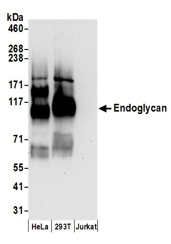 Endoglycan Antibody in Western Blot (WB)