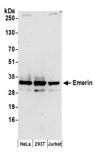 Emerin Antibody in Western Blot (WB)