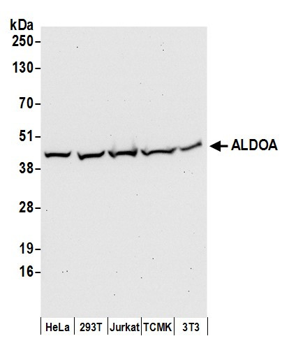 ALDOA Antibody in Western Blot (WB)