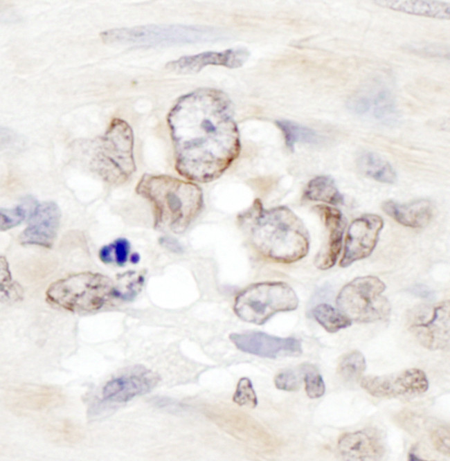 Aladin Antibody in Immunohistochemistry (Paraffin) (IHC (P))