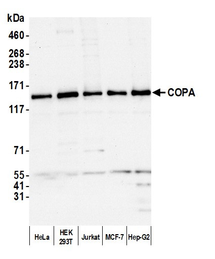 COPA Antibody in Western Blot (WB)
