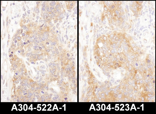 COPB2 Antibody in Immunohistochemistry (Paraffin) (IHC (P))