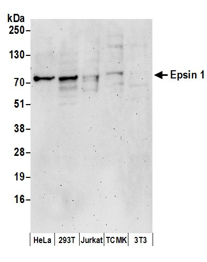 Epsin 1 Antibody in Western Blot (WB)