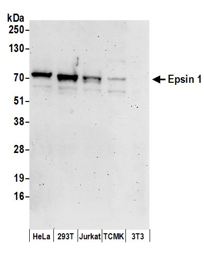Epsin 1 Antibody in Western Blot (WB)