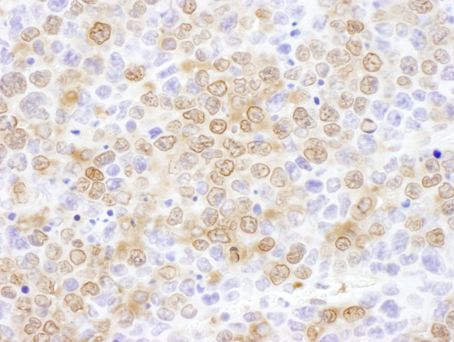 NUDC Antibody in Immunohistochemistry (Paraffin) (IHC (P))