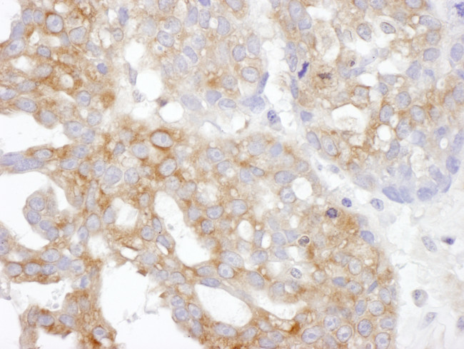 IL14 Antibody in Immunohistochemistry (Paraffin) (IHC (P))