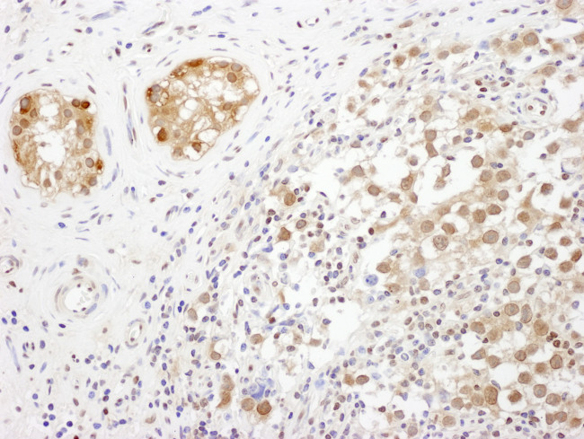 TRAX Antibody in Immunohistochemistry (Paraffin) (IHC (P))