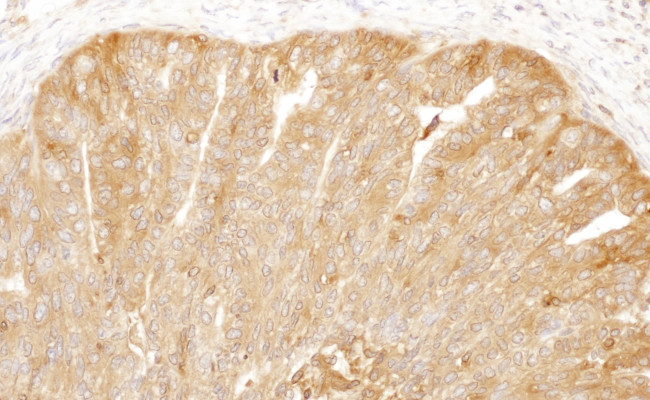 CAP1 Antibody in Immunohistochemistry (Paraffin) (IHC (P))