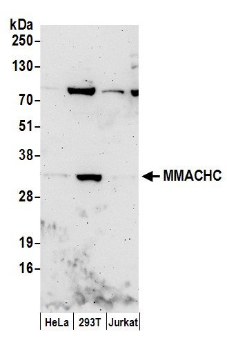 MMACHC Antibody in Western Blot (WB)
