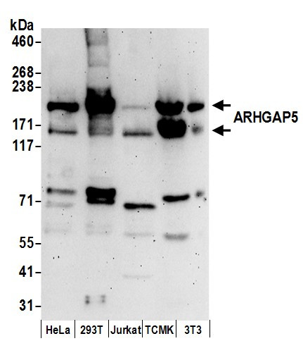 ARHGAP5 Antibody in Western Blot (WB)
