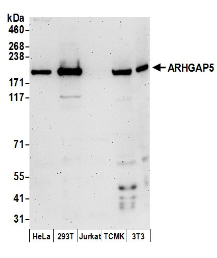 ARHGAP5 Antibody in Western Blot (WB)