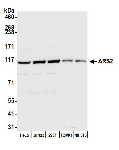 ARS2 Antibody in Western Blot (WB)
