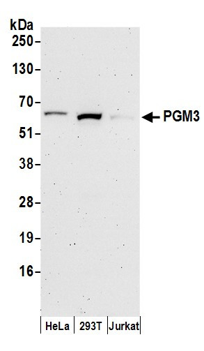 PGM3 Antibody in Western Blot (WB)