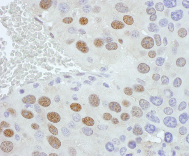 PCYT1A Antibody in Immunohistochemistry (Paraffin) (IHC (P))