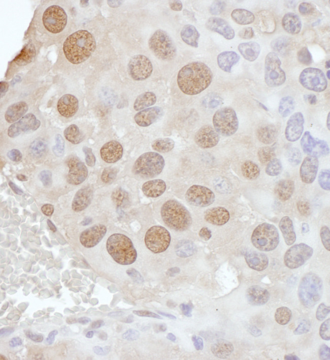 PCYT1A Antibody in Immunohistochemistry (Paraffin) (IHC (P))