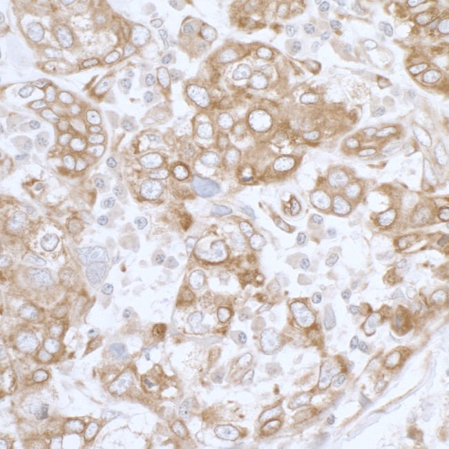 PGRMC1 Antibody in Immunohistochemistry (Paraffin) (IHC (P))