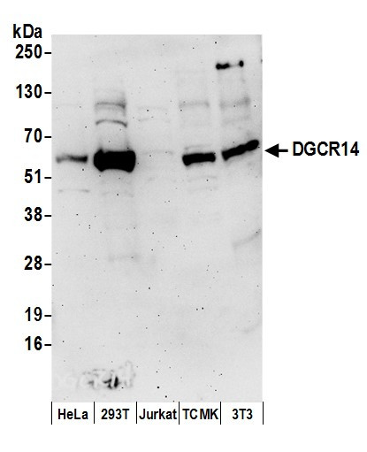 DGCR14 Antibody in Western Blot (WB)