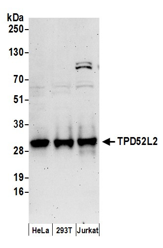 TPD52L2 Antibody in Western Blot (WB)