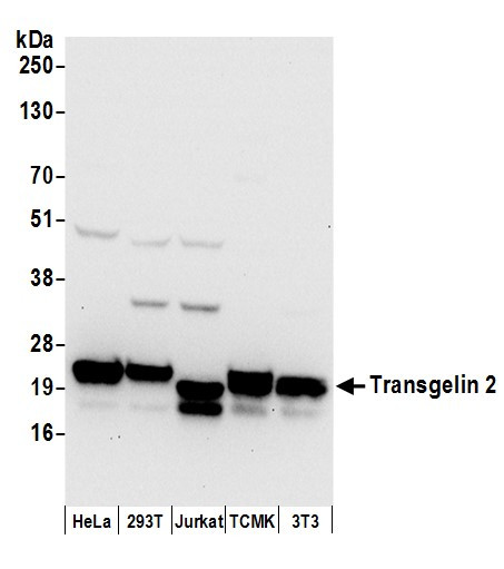 Transgelin 2 Antibody in Western Blot (WB)