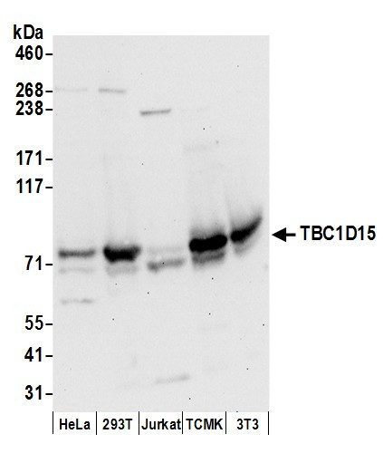 TBC1D15 Antibody in Western Blot (WB)